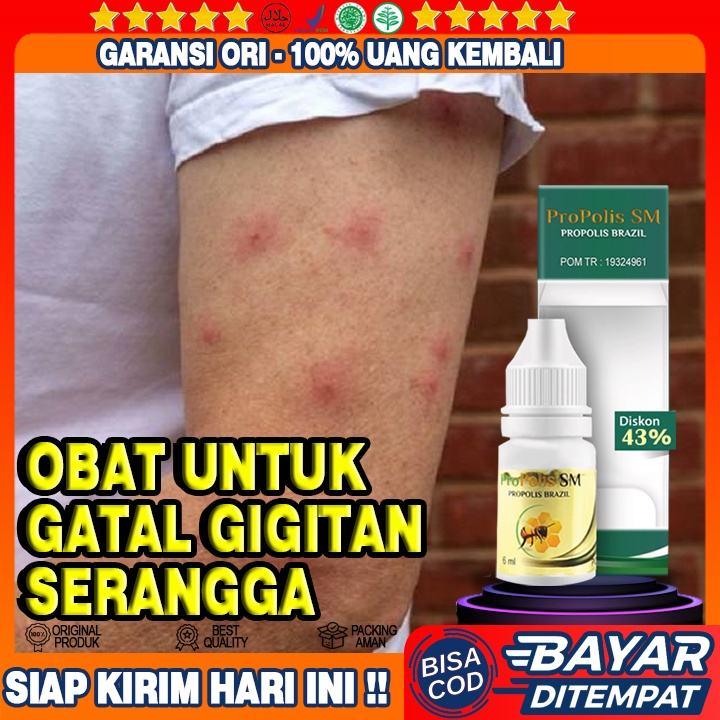 Obat Gatal Digigit Serangga