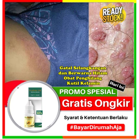 Obat Eksim Exim Basah Kering Gatal Selangkangan dan Berwarna Hitam - Obat Penghilang - Kutil Kelamin
