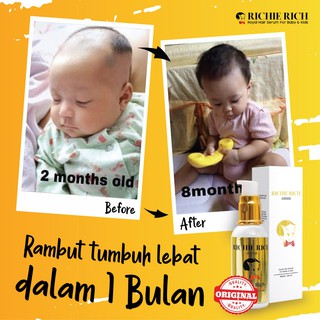  Richie  Rich  Hair Serum Vitamin  Minyak Kemiri Penyubur 