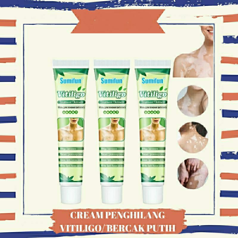 Original Sumifun Penghilang Vitiligo Salep Cream Vitiligo Bintik Putih