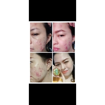Gold jelly kedas beauty(cod)-1