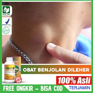 Jual Obat Benjolan Di Leher - Pembengkakan Kelenjar Getah Bening ...