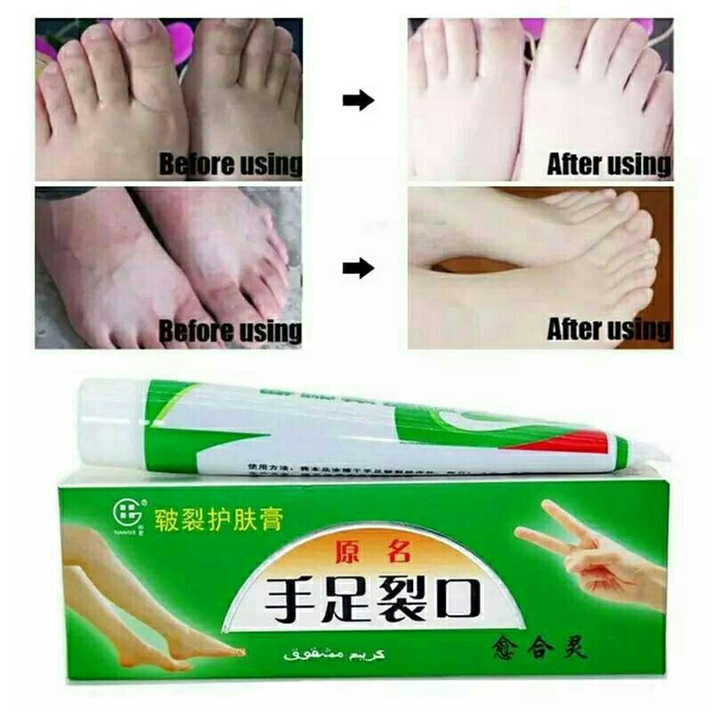 Cream kaki tangan pecah2 Cream tumit kering