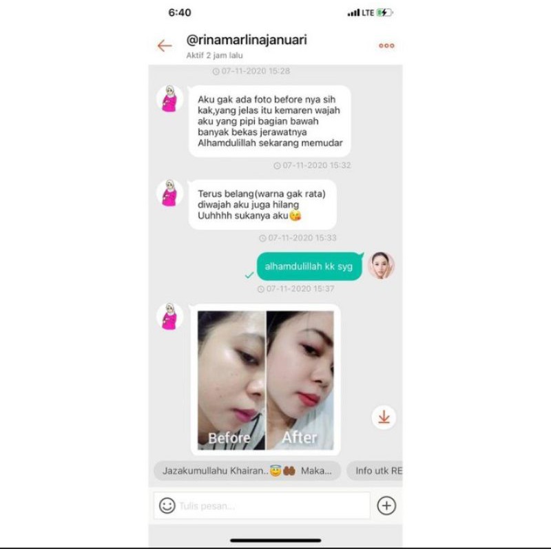 Paket flek whitening wajah kusam dan flek memutihkan aman ori bpom krim farma dokter farmasi cream