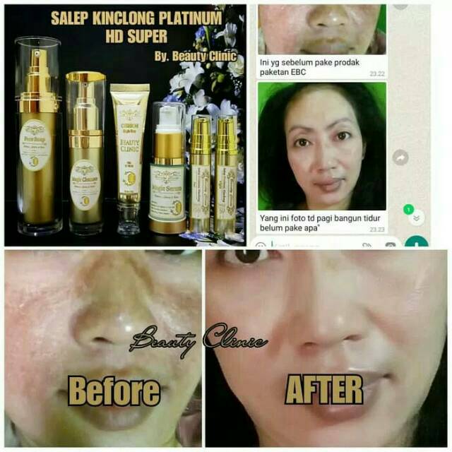 Salep kinclong platinum hd super ultimate spw beauty clinic pelicin wajah