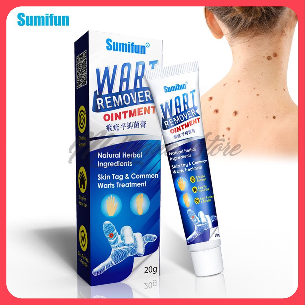 Skin Tag Remover Menghilangkan Kutil Tahi Lalat Mata Ikan - SUMIFUN Wart Remover Ointment