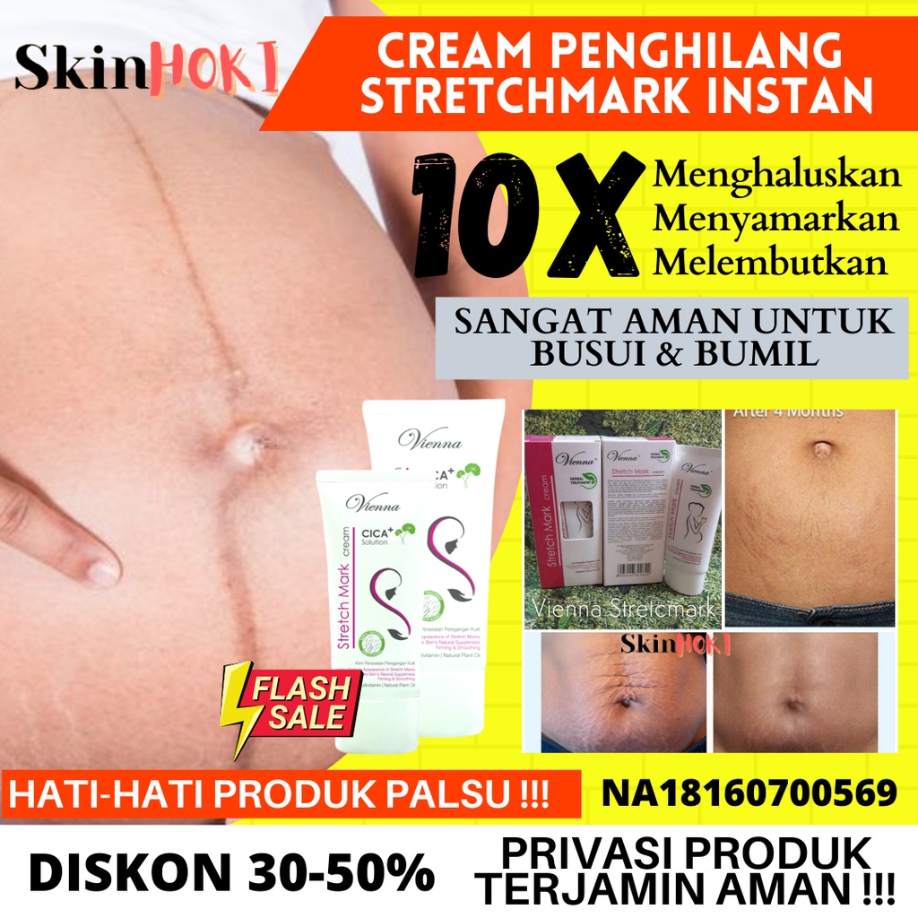 PENGHILANG STRETCH MARK IBU HAMIL PENGENCANG KULIT VIENNA STRETCHMARK CREAM 80ML PENCERAH KULIT CREAM PERAWATAN KULIT ORIGINAL BPOM