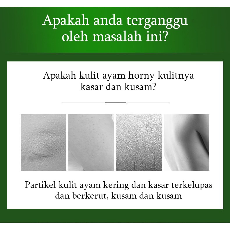 【Barang ready】scrub pengelupasan kulit  niacinamide scrub body dan butt eksfoliasi mengeksfoliasi lulur tubuh whitening scrub pemutih body pengelupasan kulit mati meningkatkan kulit halus pemutih kulit