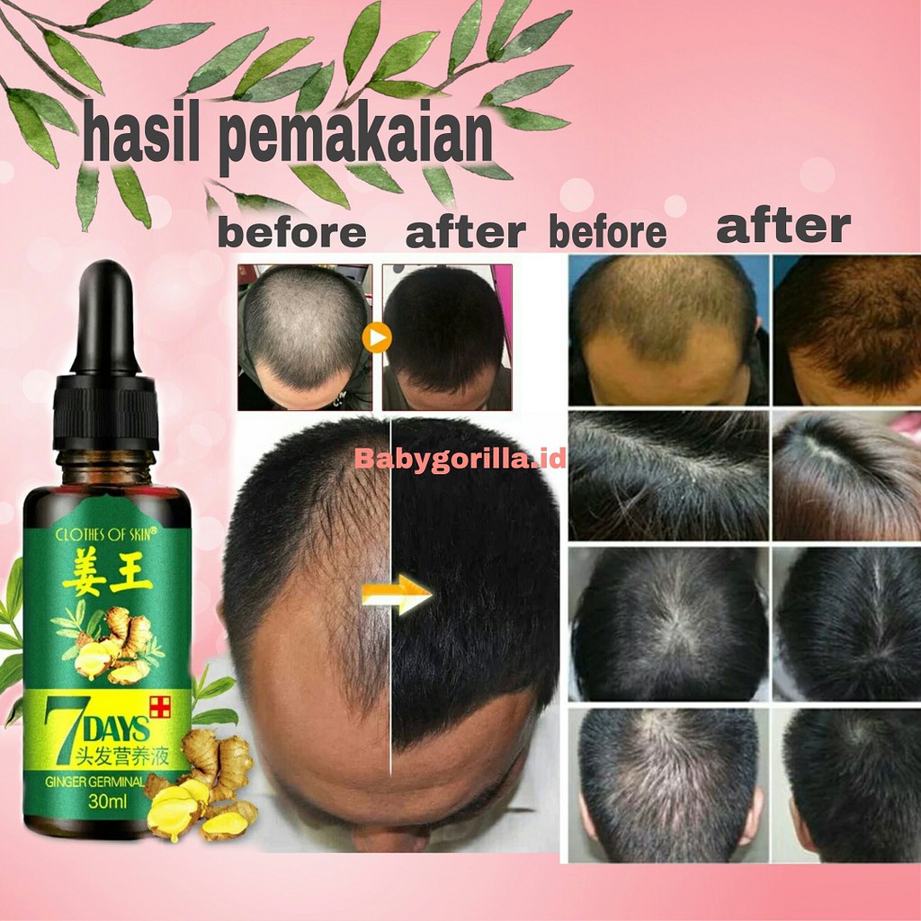 Cairan Essence Penumbuh Rambut Anti Rontok Serum Obat kebotakan Nutrisi Rambut Jahe-Babygorilla.id-4