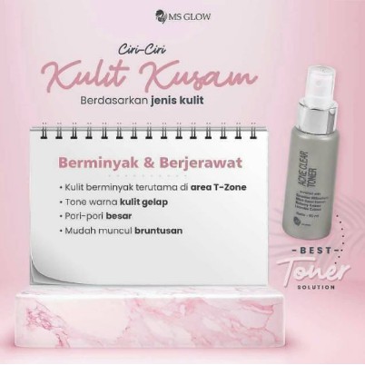 MS GLOW TONER / TONER GLOWING MS GLOW / TONER ACNE MS GLOW [ ORIGINAL 100% ]