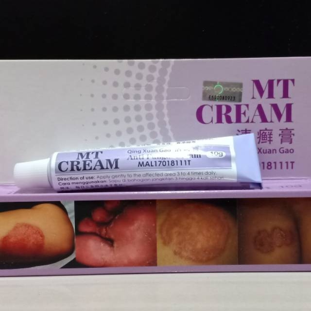 promo MT CREAM (Qing Chuan Gao) Anti Fungal Cream - Salep Kulit Gatal, Jamur