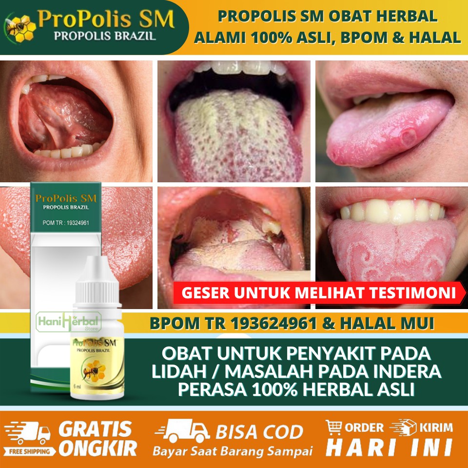 3 Ramuan Alami Ini Ampuh Jadi Obat Untuk Lidah Mati Rasa