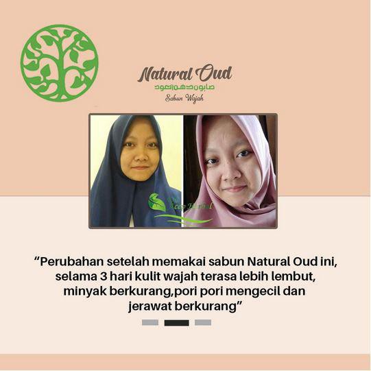 Sabun Penghilang Milia Paling Berkhasiat - Obat/Sabun Penghilang Bruntusan, Penghancur Bintik Bintik Dekat Mata, Di Jidat, Di Pipi, Di hidung, Bintik Bintik Kecil, Bintik Putih, Penghancur Milia Dengan Natural Oud Asli 100% Original - Bisa COD