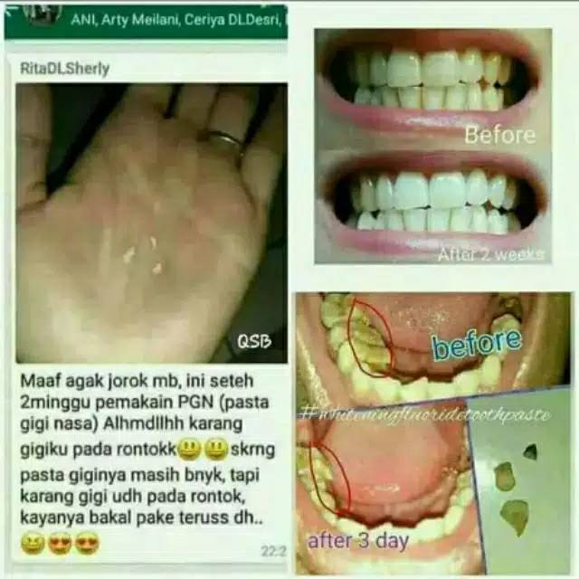 ✿ELYSABETHME✿ Pasta gigi odol nasa obral murah resmi menghilangkan plak dan bau mulut mencegah teeth  berlubang