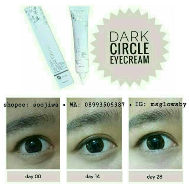 Dark Circle Eye Cream MS Glow by Cantik Skincare / Krim Pemutih Kantong Mata