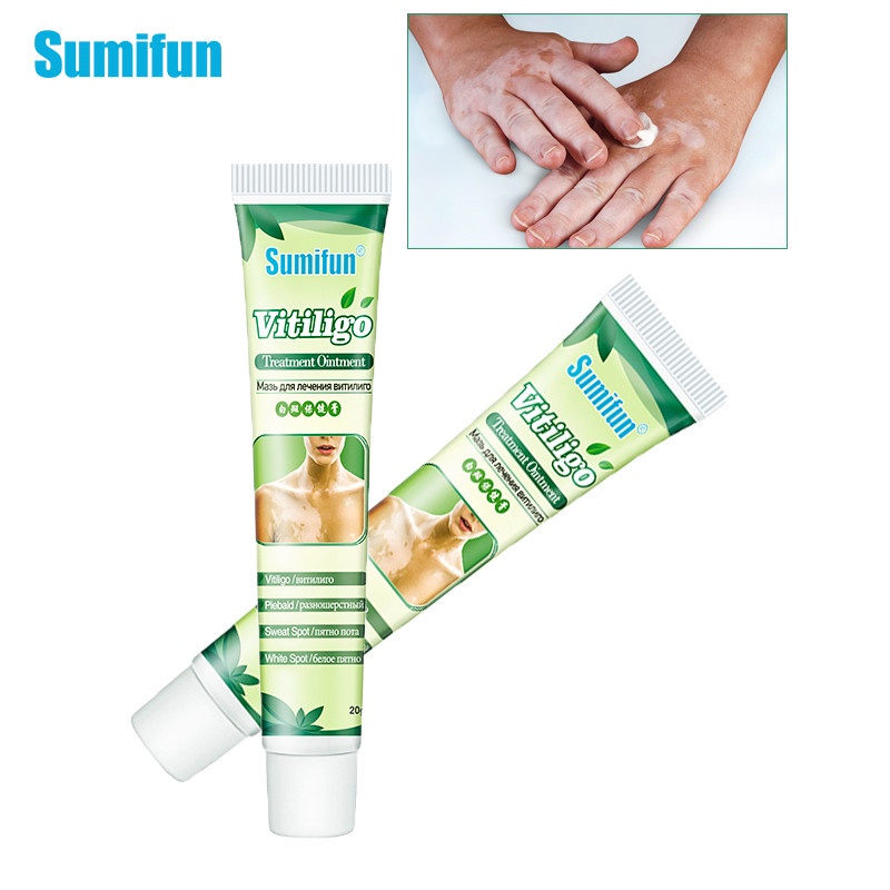 Sumifun Obat Salep Vitiligo Brecak Putih / Kulit Belang Pitih Krim Vitiligo Herbal - 20gr