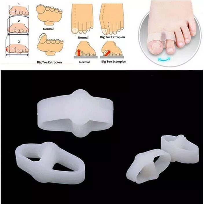 Pemisah jari kelingking gel silicone bunion separator  hallux valgus