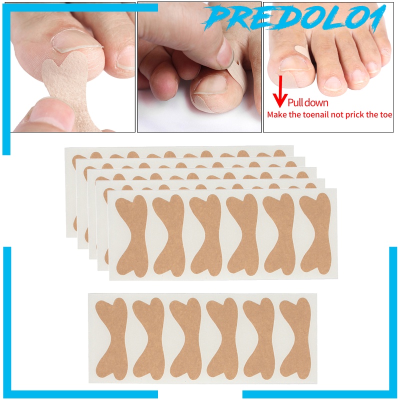[PREDOLO1]Ingrown Toenail Stickers Elastic Glue Free Painless Nail Correction Foot nail Patches for Women Men