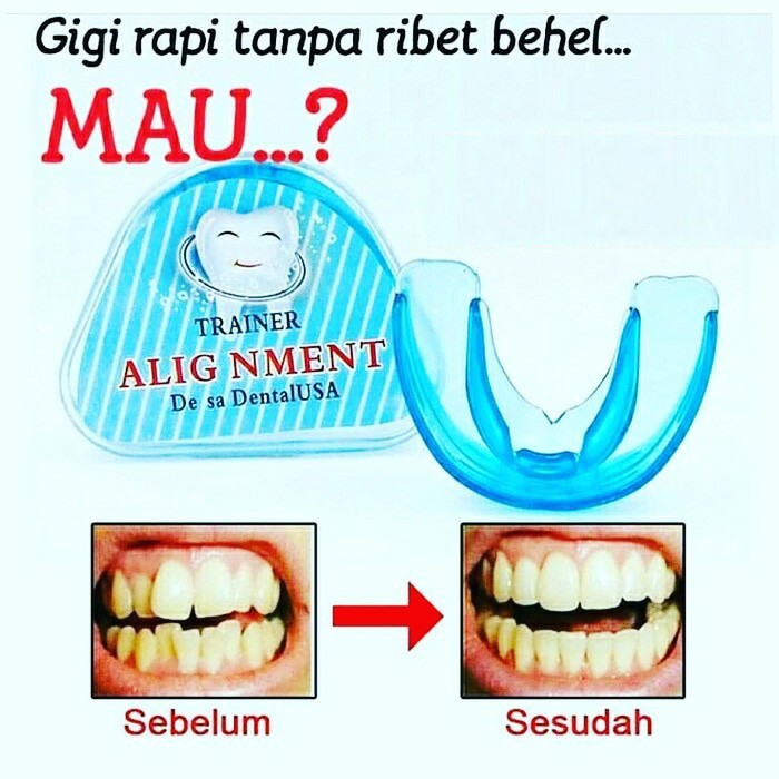 alat Perapih karet Aligner Behel gigi Teeth Trainer Alignment Merapikan Tonggos Gingsul Perapi Maju 