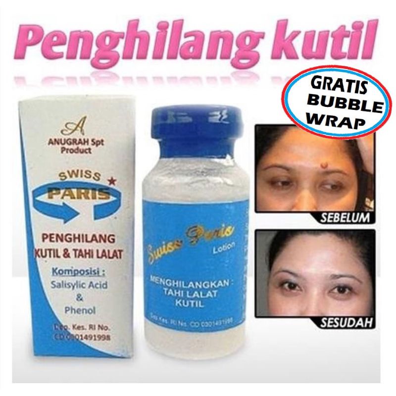 swiss paris penghilang kutil dan tahi lalat