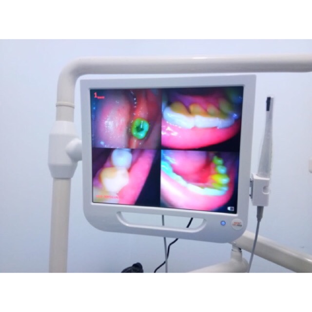 Intra oral camera set