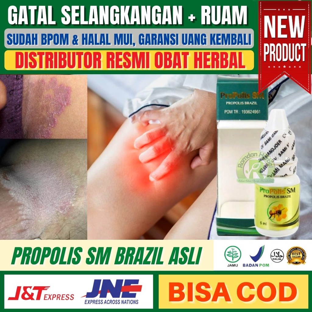 Obat Selangkangan Gatal Disertai Ruam Bekas Hitam Gatal Selangkangan Eksim Gatal Eksim Kering Gatal 