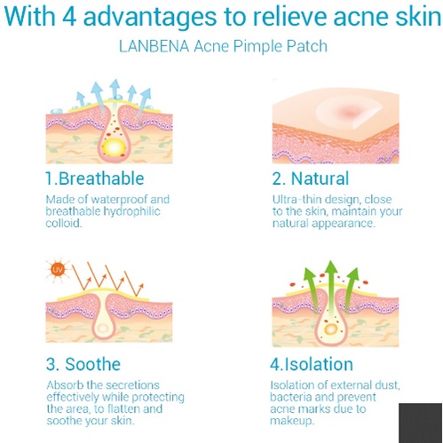 [ COD ] LANBENA ANTI ACNE PIMPLE PATCH DAY N NIGHT / OBATI JERAWAT TANPA DI PENCET DAN BEKAS