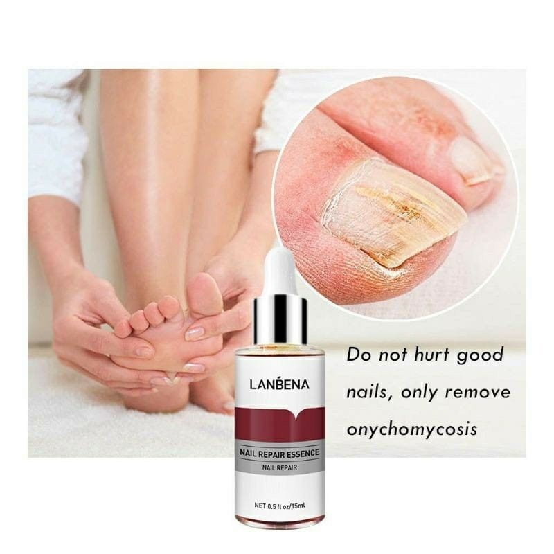 Beauty Jaya - Lanbena Nail Repair Essence Serum Perawatan Jamur Kuku Manicure Pedicure