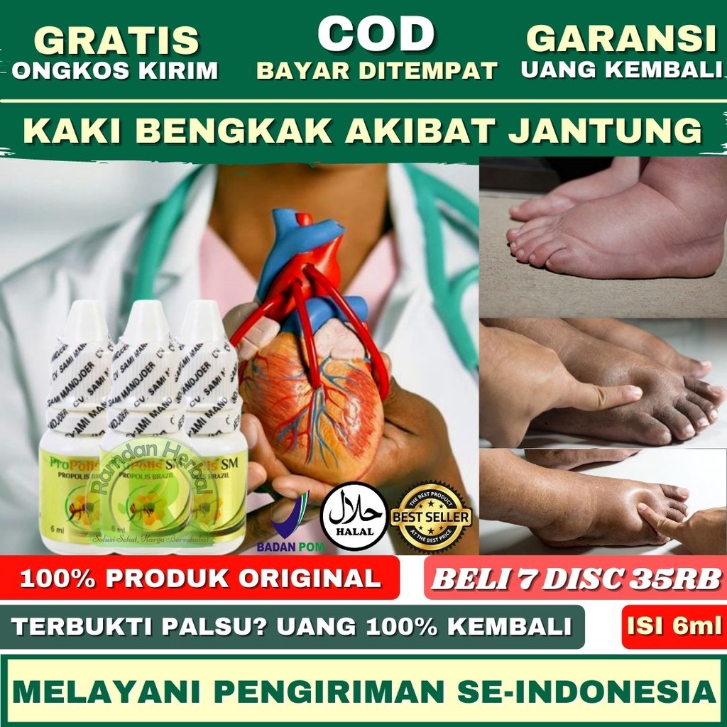 [BPOM] Obat Kaki Bengkak Akibat Jantung-Kaki Bengkak Asam Urat-Kaki Bengkak Cantengan-Kaki Bengkak D