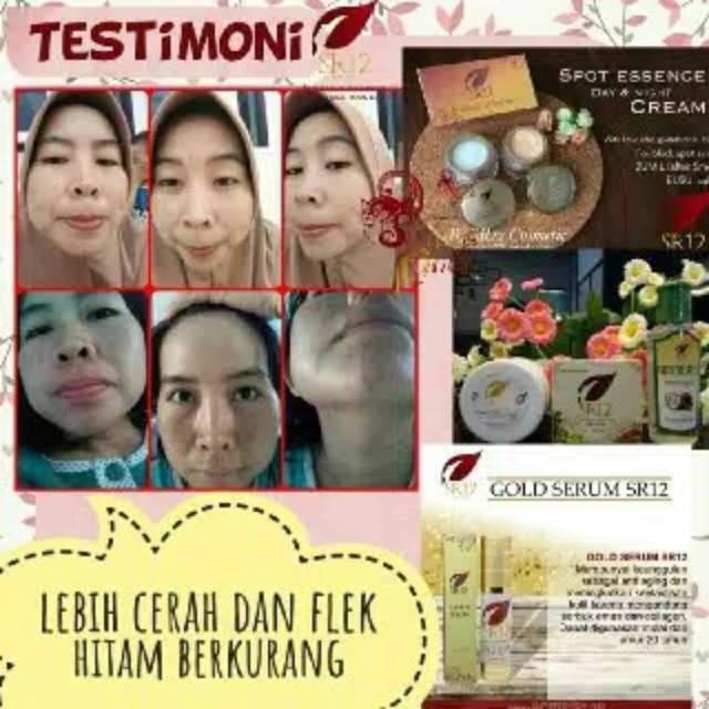 TUMPAS FLEK HITAM TERAMPUH Spot Essence SR12 Day &amp; Night Cream BPOM FLEK HITAM BEKAS JERAWAT BLILA