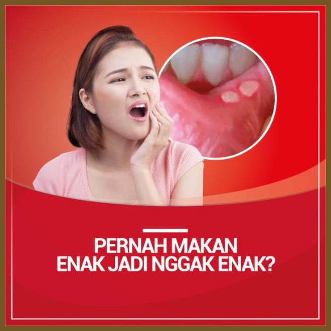 Joypolinse Obat Sariawan Mulut | Obat Bau Mulut Kumur Ampuh