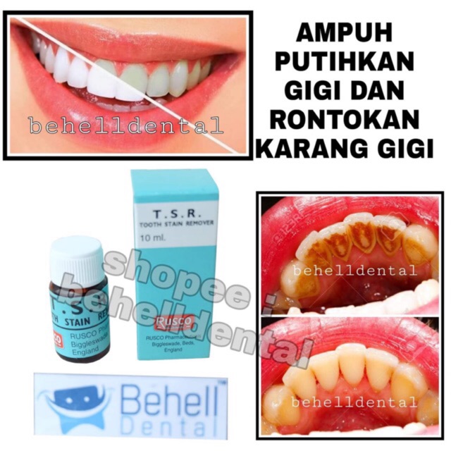 TSR ORI | PEMUTIH GIGI AMPUH PENGHILANG BAU MULUT PELUNAK KARANG GIGI BLEACHING WHITENING TEETH