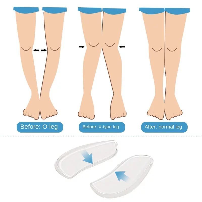 INSOLE SEPATU GEL SILICON UNTUK KAKI O DAN X ALAS SEPATU SOL SEPATU WANITA