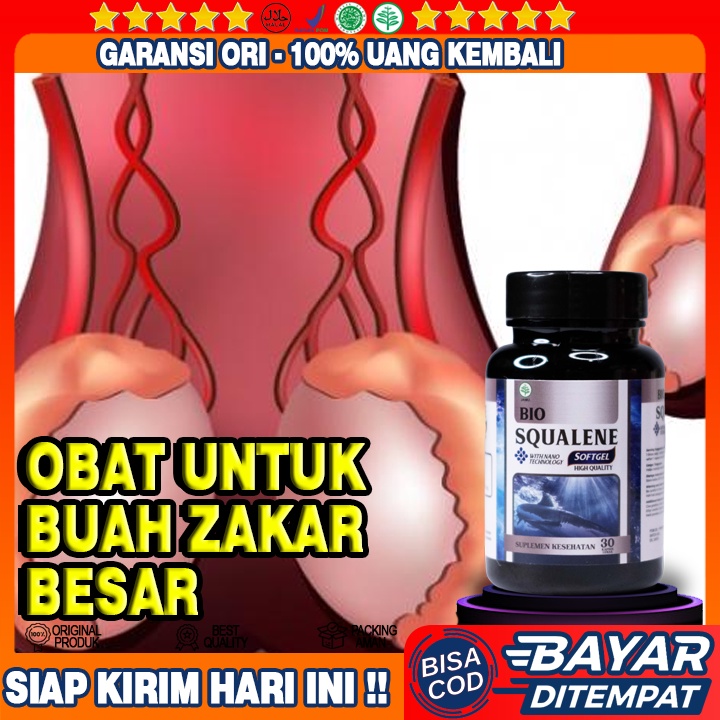Obat Buah Zakar Besar - Buah Zakar Besar Sebelah - Testis Besar Sebelah - Varikokel Bengkak - Buah Z
