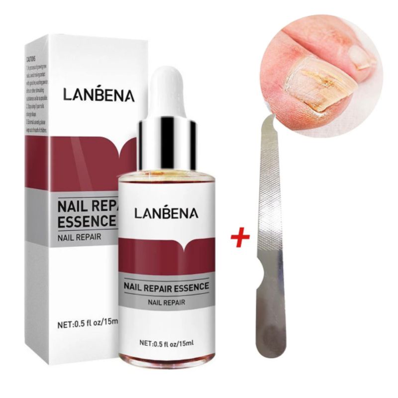 Lanbena Nail Repair Essence [Gratis Alat Kikir Kuku] / Lanbena Perawatan Kuku Kaki &amp; Tangan / Lanbena Serum Perawatan Kuku / Lanbena Oil Serum Nail Treatment / Lanbena Perawatan Kuku Esensi Serum Jamur Kuku / Serum Perawatan Jamur Kuku Pecah Kasar