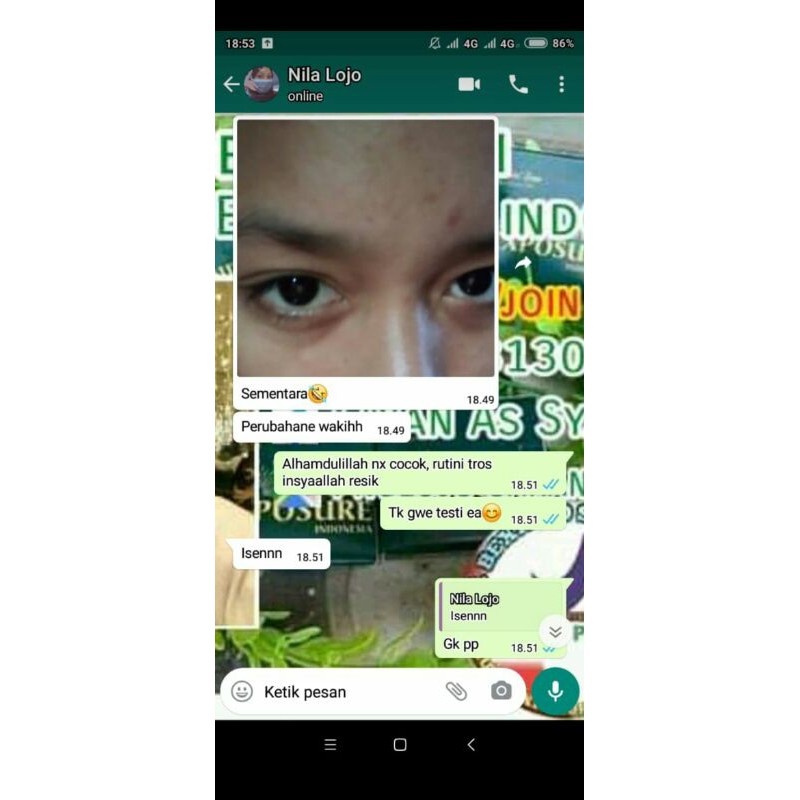 

bexindo(beautyexposureindonesia)