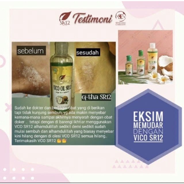 SR12 VCO Virgin Coconut Oil Suplemen Kesehatan Vitamin Busui Herbal Minyak Kelapa Natural Untuk Rambut Pelembab Kulit Kering BPOM