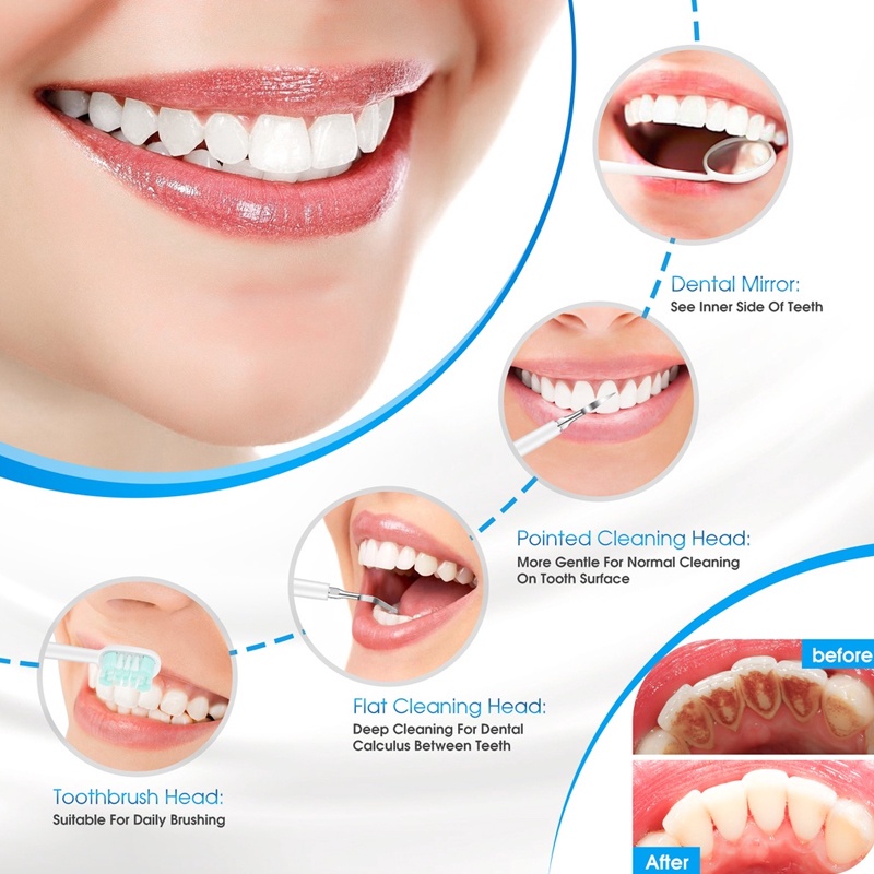 Kaikki Alat Pembersih Karang Gigi Dental Scaling Sonic Elektrik/  2 in 1 alat pembersih karang gigi/tahan air alat pembersih karang gigi elektrik