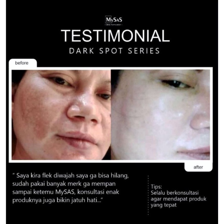 Mysas paket FLEK 5 item