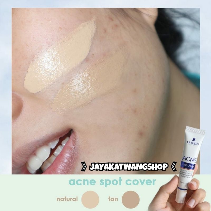 LA TULIPE Acne Spot Cover / Latulipe