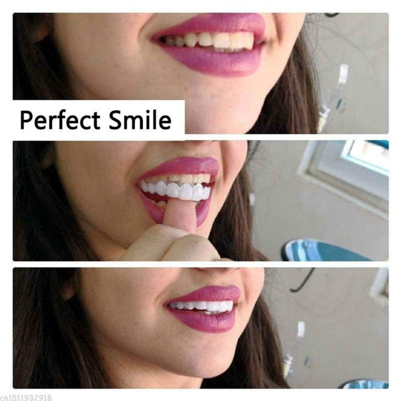 Snap On Smile 100％ORIGINAL Authentic / Fake Gigi 1 Set Snapon Smile