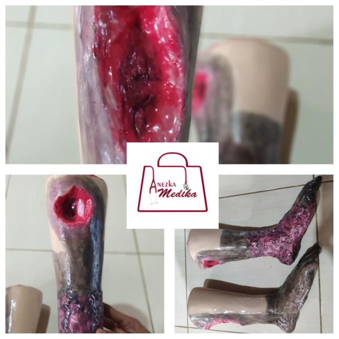 Phantom/Manekin/Manikin Kaki Luka Decubitus