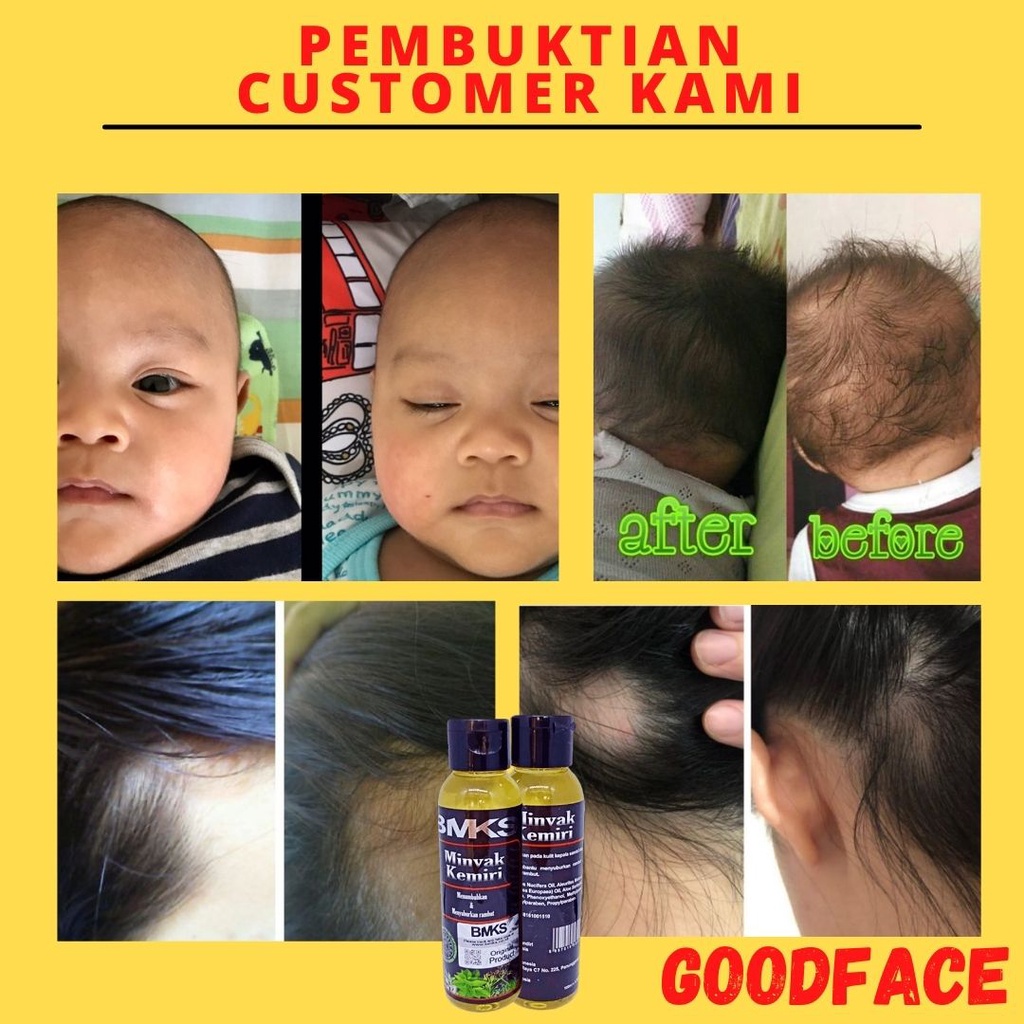 MINYAK KEMIRI BMKS ORIGINAL PENUMBUH RAMBUT RONTOK AMPUH TREATMENT RAMBUT