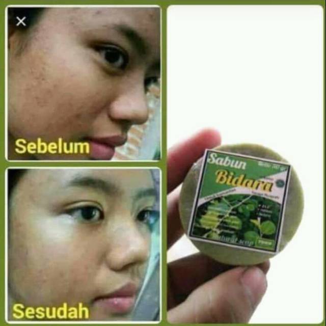 Sabun herbal/sabun bidara