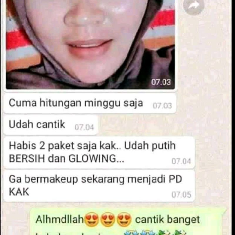 KRIM PEMUTIH WAJAH GLOWING PENGHILANG FLEK DALAM 5 HARI ECER KRIM ZAYORA SKINCARE UNTUK KULIT SUSAH PUTIH FLEK HITAM JERAWAT BRUNTUSAN DAN NORMAL