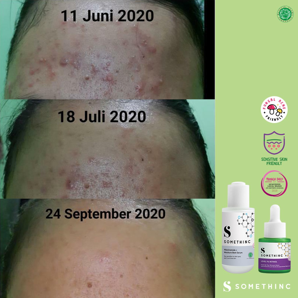 Somethinc Level 1% Retinol Penghilang Jerawat Komedo Kerutan Bruntusan Bekas Luka Wajah