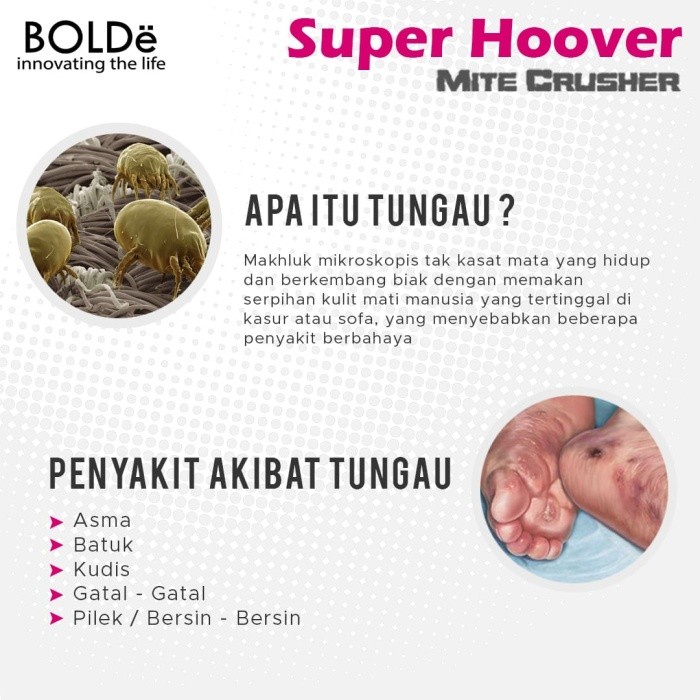 BOLDe SUPER HOOVER MITE CRUSHER X WIRELESS - Vacuum Cleaner UV Pembasmi Tungau dan Bakteri