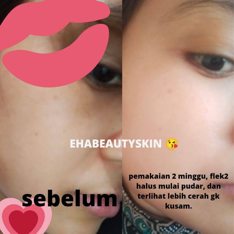 ehabeautyskin/skincare ehabeautyskin/skincare murah