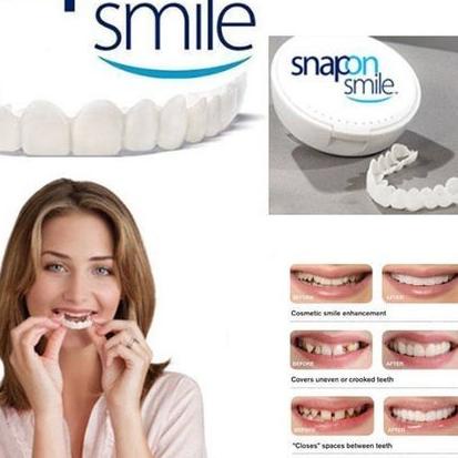 BISA COD ✔️Snap On Smile 100% ORIGINAL Authentic / Gigi Palsu Snapon Smile 1 Set Atas dan Bawah|KD1