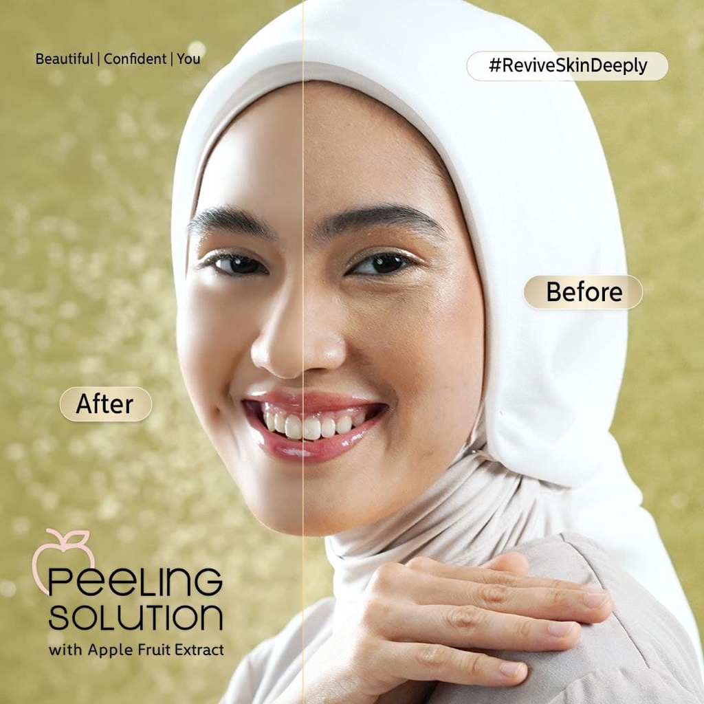 Peeling Solution with Apple Fruit Extract Eksfoliasi Kulit Mati Memudarkan Flek Membersihkan Pori by B ERL